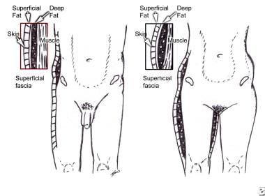 Anatomy of the superficial fascial system in males