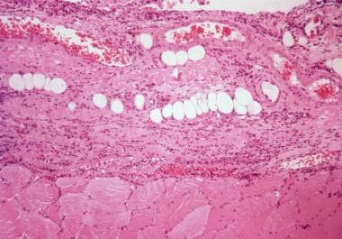 Photomicrograph of fascia-skeletal muscle junction
