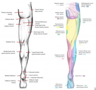 Cauda Equina And Conus Medullaris Syndromes Clinical - 