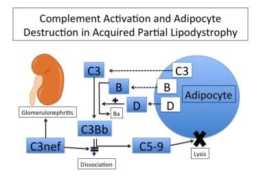 Model of the adipocyte destruction in acquired par