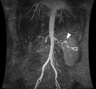 Magnetic resonance imaging of a patient with 2 lef