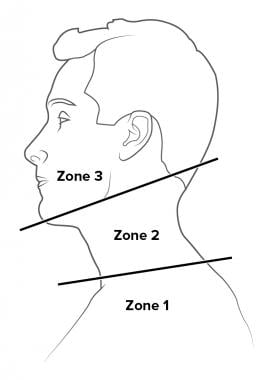 hard soft signs neck trauma