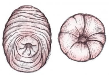 Diagram depicting clinical difference between true