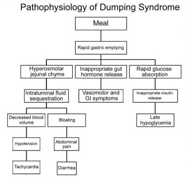 Pathophysiology of dumping syndrome. 