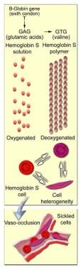 Molecular and cellular changes of hemoglobin S. 