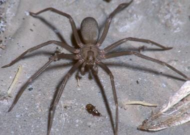 Typical appearance of a male brown recluse spider.