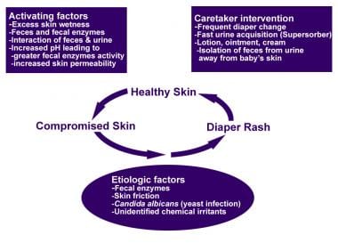 Diaper Rash: Practice Essentials, Pathophysiology, Etiology