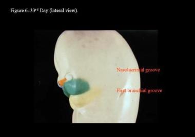 Head and neck embryology. 33rd day (lateral view).