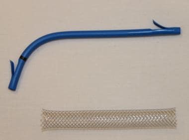 Biliary stents. Upper stent is plastic stent; lowe