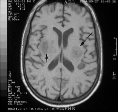 T1-weighted axial brain magnetic resonance image a