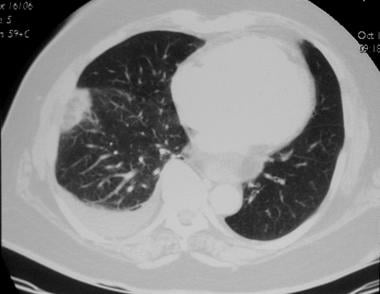 Pulmonary angiography. CT image obtained by using 