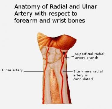 Radial and ulnar arteries. Because of the tortuosi