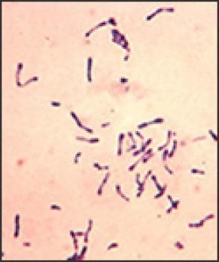 Photomicrograph depicts a number of gram-positive 