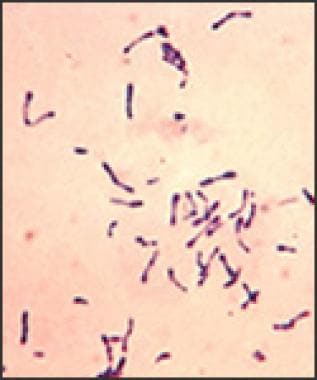 diphtheria bacteria