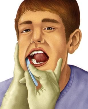Oral mucosal examination. 