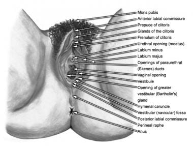 Reference points tattooed at the level of mons pubis (reference