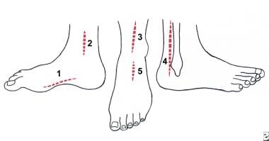 Foot Drop: Practice Essentials, Anatomy, Pathophysiology