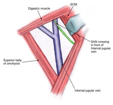 Relationship of internal jugular vein to the spina