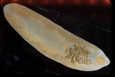 Adult fluke of Fasciolopsis buski. Image reproduce