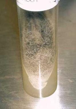 The appearance of a culture slant of Rhizopus spec