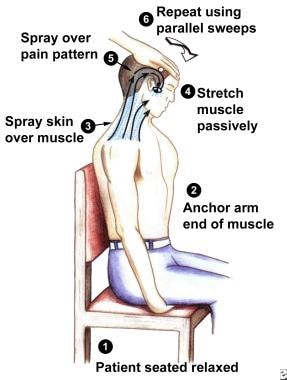 Sequence of steps to use when stretching and spray