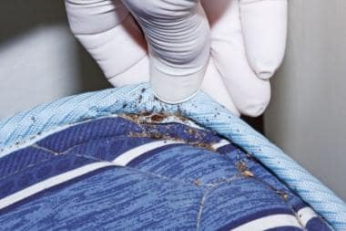 Fecal staining from bed bugs in the crevice of a m