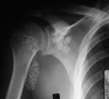 Plain radiograph of a 19-year-old man who initiall