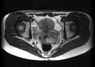 Axial T2-weighted magnetic resonance image of stag