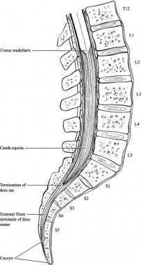 Illustration demonstrating the relevant anatomy of