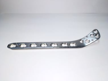 Lateral tibial locking compression plate.