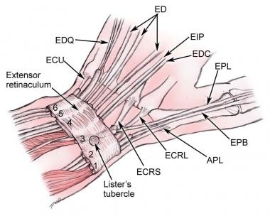 The extensor tendons of the wrist and hand are div