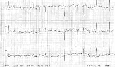 A 62-year-old woman with a history of chronic stab