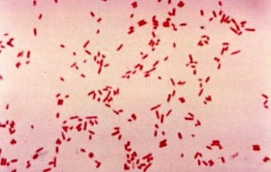 
Escherichia coli on Gram stain. Gram-negative bac