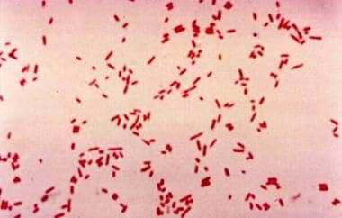 gram negative rods in wound culture