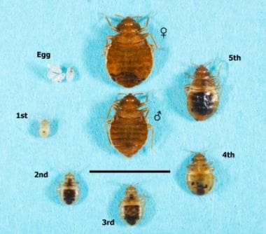 Various stages of the bed bug life cycle. © 2014 A