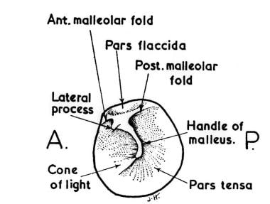 Otitis Media: Practice Essentials, Background, Pathophysiology