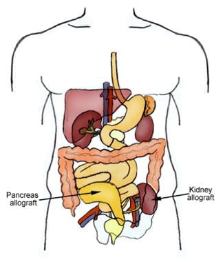 An after characteristics that determinations out who WORRIES Action affecting member aids