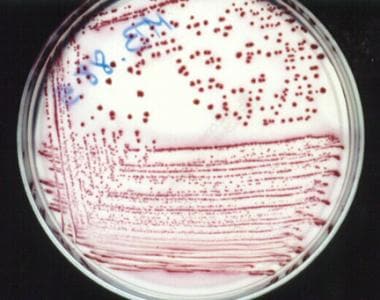 E Coli Bacteria In Stool Culture