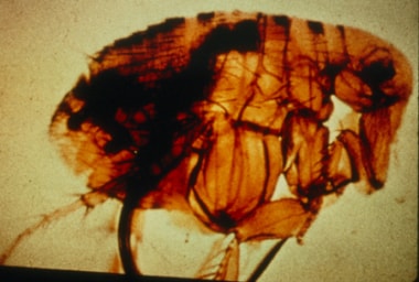Pictured is a flea with a blocked proventriculus, 