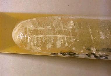 A fresh agar slant of Sporothrix schenckii reveals