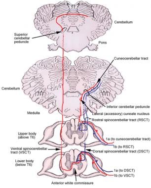 Solved Most somatosensory information decussates in the