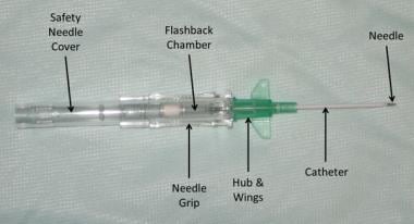 external jugular vein cannulation