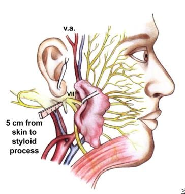 facial nerve anatomy