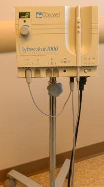 An office-based, portable electrosurgical unit. 
