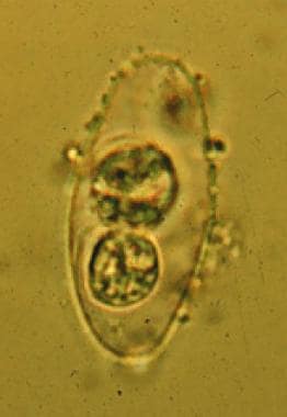 Oocyst of Cystoisospora belli with 2 sporoblasts. 