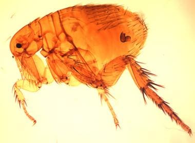 The Oriental rat flea (Xenopsylla cheopis). Image 