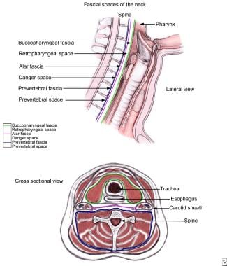 Schematic of neck deep space anatomy, as illustrat