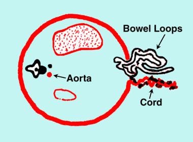 Diagram of the transverse section of the fetal abd