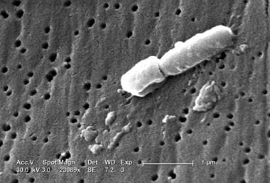 klebsiella pneumoniae gram stain morphology