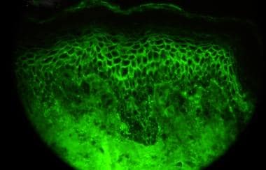 Direct immunofluorescence microscopy performed on 